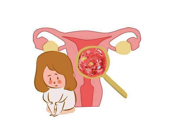 女子长期月经不调查出子宫内膜癌 女子长期月经不调查出子宫内膜癌